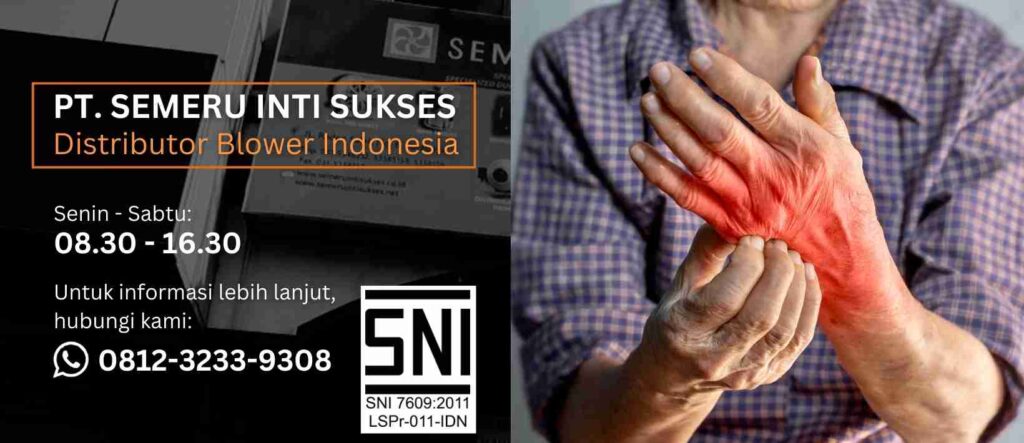 Infeksi Jamur pada Kulit